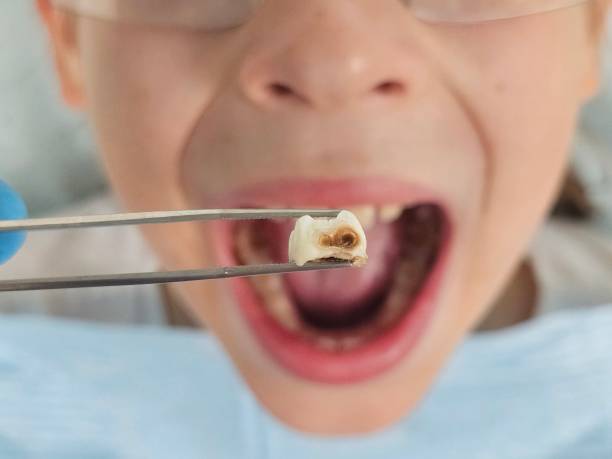 Best Emergency Treatment for Toothache in Glenwood, GA