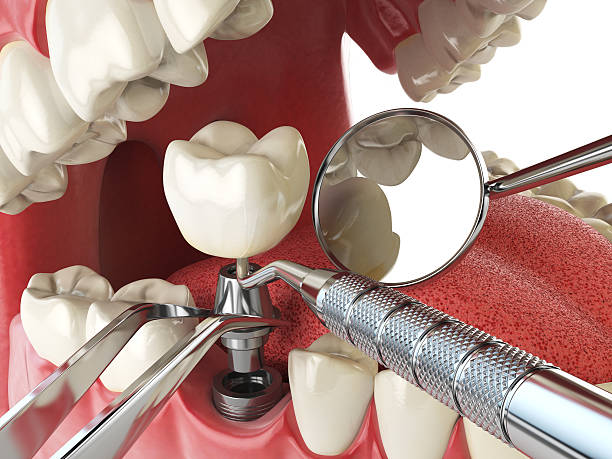 Best Emergency Dental Care for Trauma or Injury in Glenwood, GA